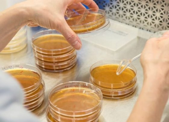 Una bacteria intestinal puede promover el cáncer de colon y recto