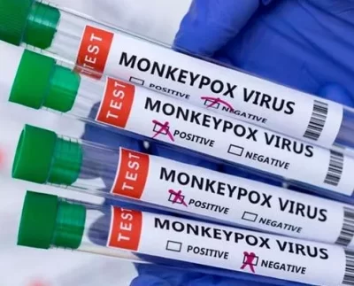 Viruela del mono se eleva a 18 el número de casos en el Perú