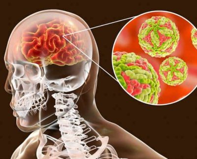 En Australia se prenden las alarmas por brotes del virus de encefalitis japonesa (JEV) en las granjas porcinas de Nueva Gales del Sur, Queensland y Victoria.