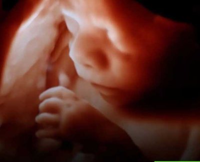 Cirujanos de Boston, EEUU llevaron a cabo un hito en la ciencia al operar el cerebro de un feto por primera vez en la historia. La intervención la llevaron a cabo experto de Boston Children's Hospital y del Brigham and Women"s Hospital.