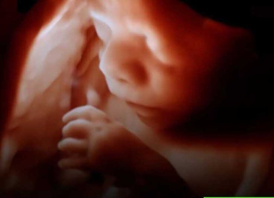 Cirujanos de Boston, EEUU llevaron a cabo un hito en la ciencia al operar el cerebro de un feto por primera vez en la historia. La intervención la llevaron a cabo experto de Boston Children's Hospital y del Brigham and Women"s Hospital.