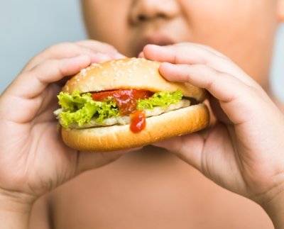 Actualmente la obesidad afecta considerablemente la calidad de vida de niños y jóvenes latinoamericanos y el problema va en aumento.