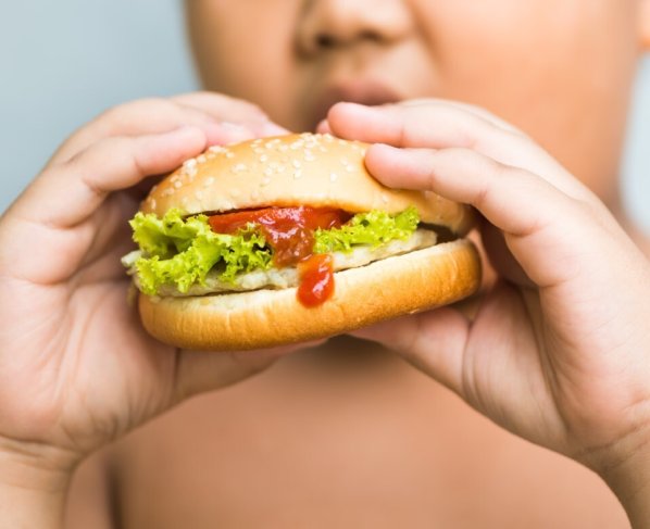 Actualmente la obesidad afecta considerablemente la calidad de vida de niños y jóvenes latinoamericanos y el problema va en aumento.