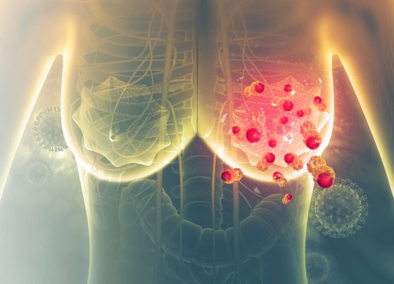 Los resultados de dicha investigación cambiarían drásticamente la forma de tratar el temido cáncer de mama.