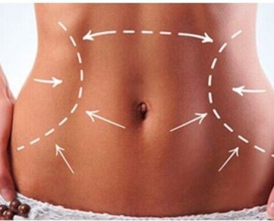 Muchas personas acuden al médico para librarse de la barriga.