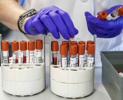 Con motivo del Día Mundial de la Hepatitis la Organización Mundial de la Salud (OMS) alertó sobre la necesidad de frenar las tendencias actuales de esta enfermedad