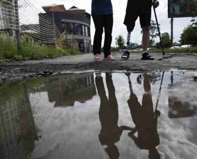 No hay suficientes especialistas en prótesis en Ucrania para hacer frente a la creciente necesidad dijo Olha Rudneva directora del centro Superhumans para la rehabilitación de amputados militares ucranianos.