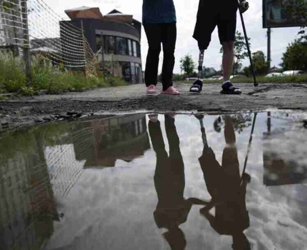 No hay suficientes especialistas en prótesis en Ucrania para hacer frente a la creciente necesidad dijo Olha Rudneva directora del centro Superhumans para la rehabilitación de amputados militares ucranianos.
