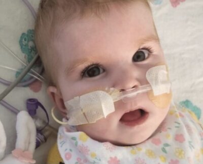 La bebé padecía de una enfermedad mitocondrial rara que afecta la producción de energía en sus células.