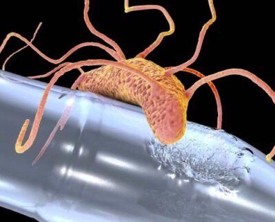 Comamonas testosteroni, que en vez de comer azúcares como la mayoría de ellas, prefiere los residuos complejos de las plantas y los plásticos y podría ser el futuro del reciclaje.