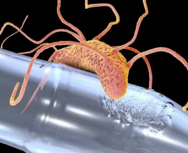 Comamonas testosteroni, que en vez de comer azúcares como la mayoría de ellas, prefiere los residuos complejos de las plantas y los plásticos y podría ser el futuro del reciclaje.