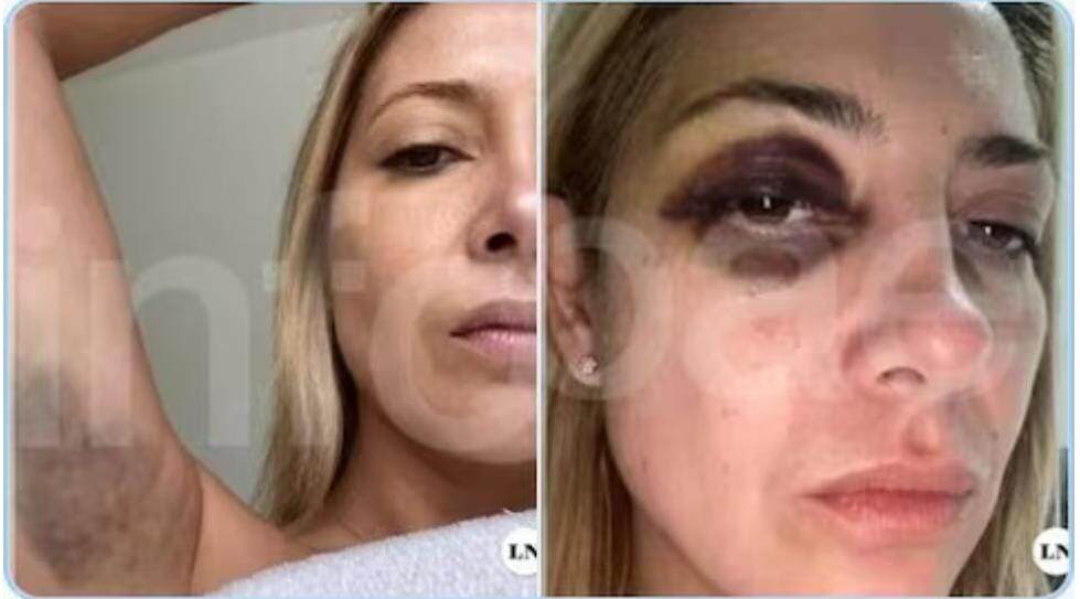 violencia de género